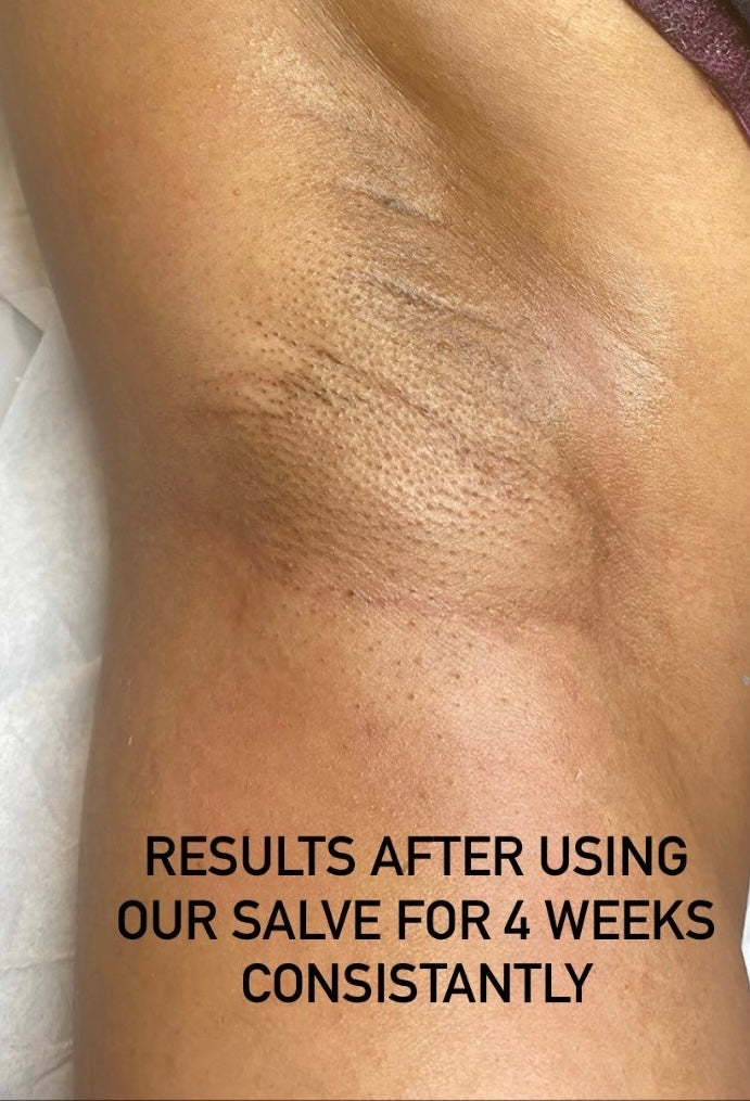 Universal Healing Salve